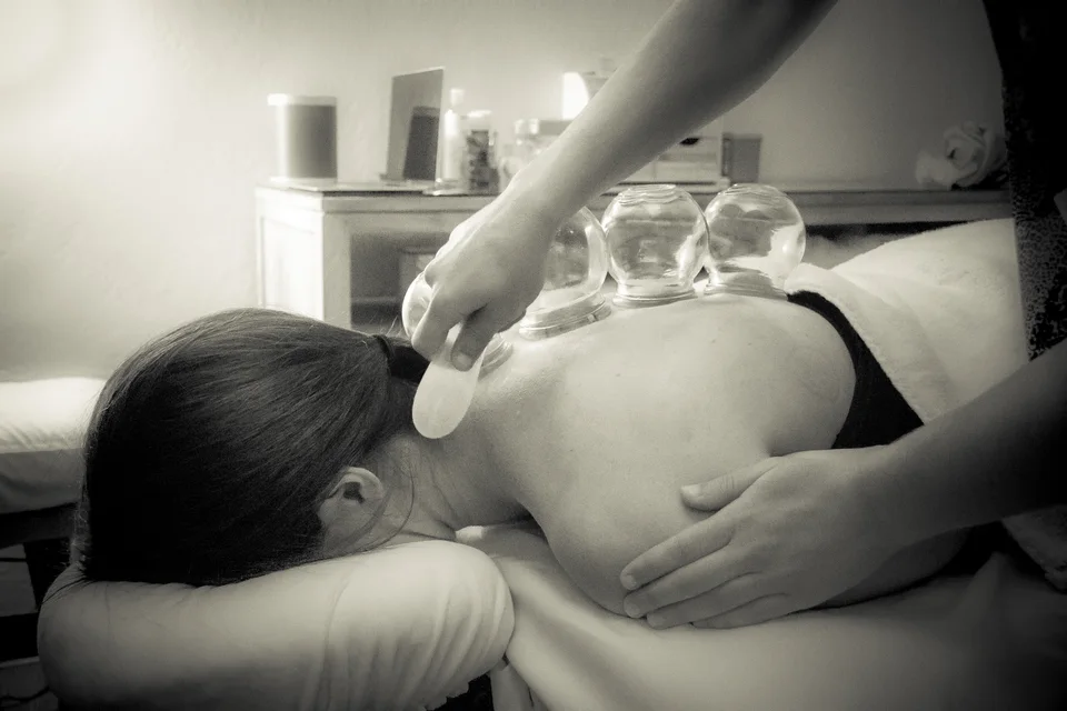 A practitioner using guasha alongside glass cupping on a patient’s back