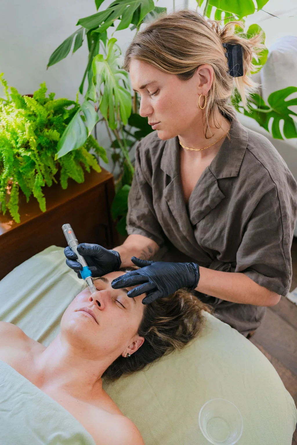 Taylar providing a microneedling treatment
