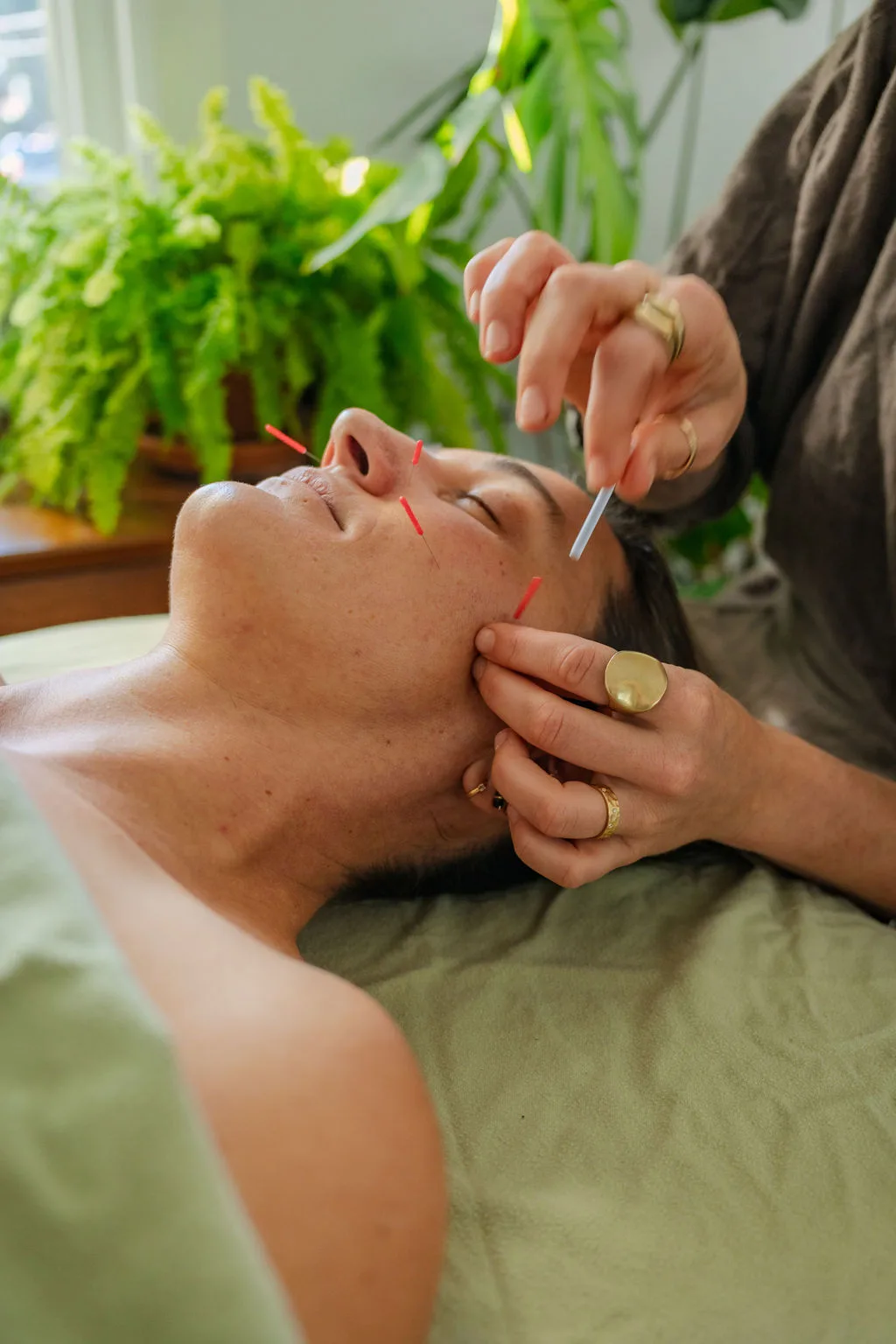 A close-up of facial acupuncture treatment