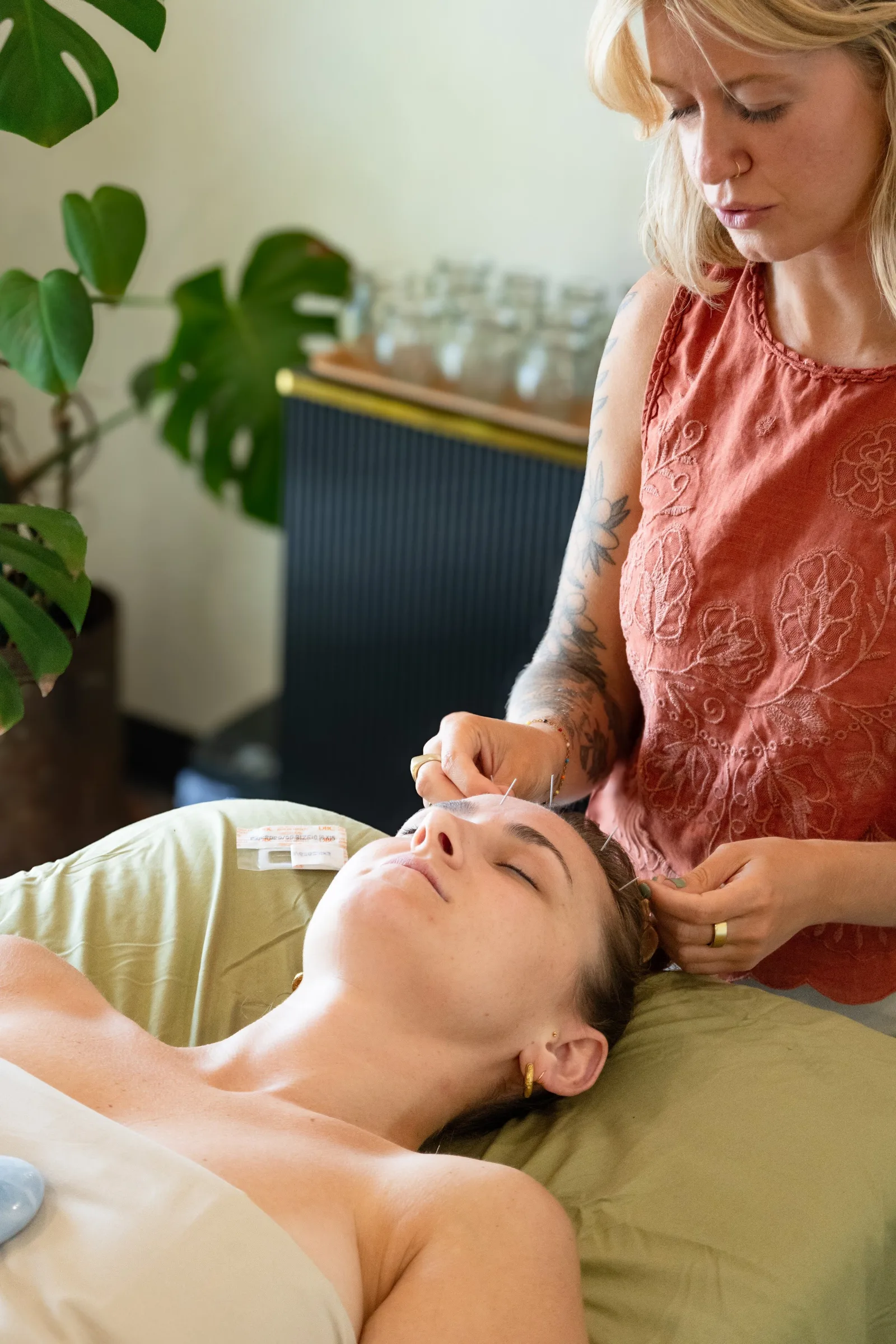 Facial acupuncture in the treatment room